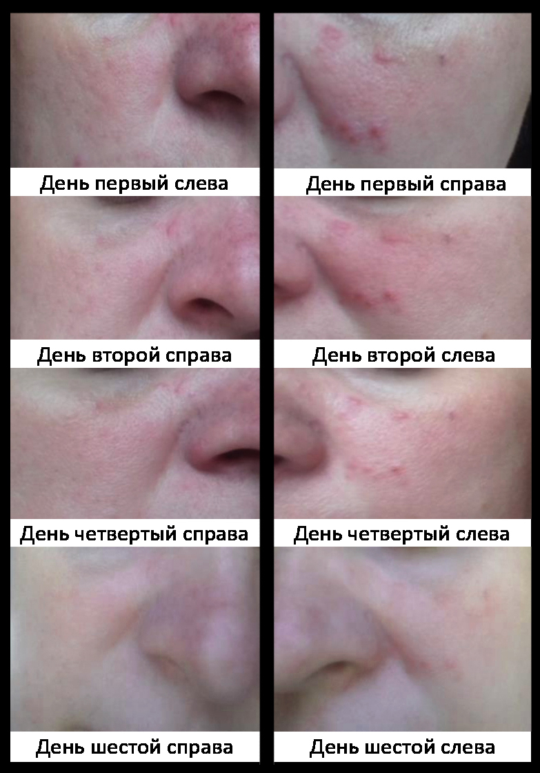 Пробиогум