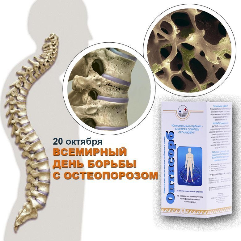 Оптисорб