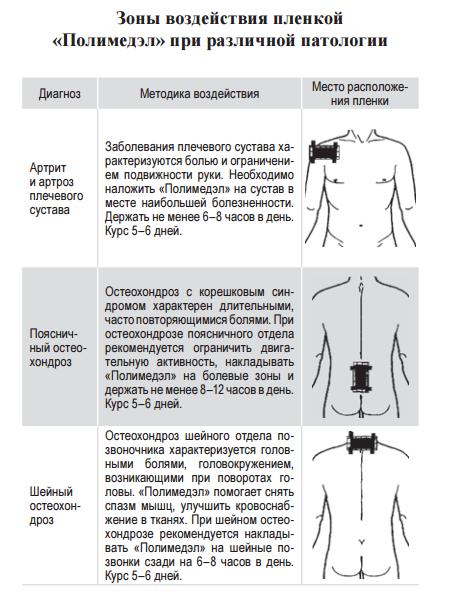 Полимедэл