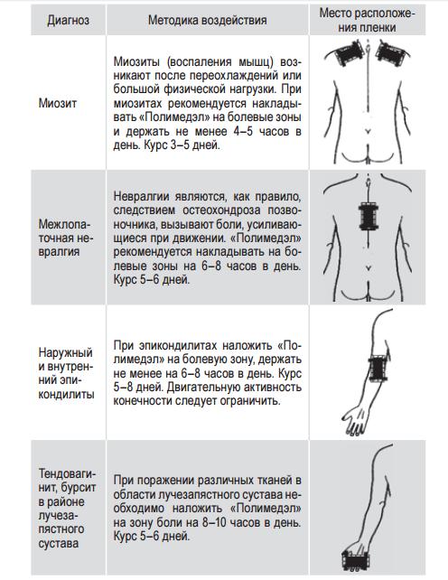 ПОлимедэл