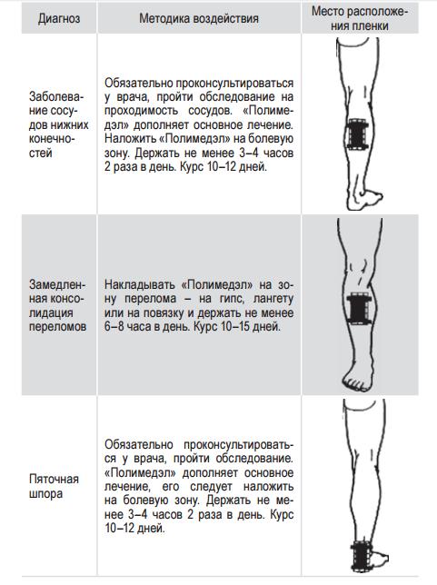 Полимедэл