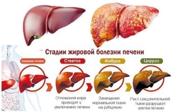 Гепатосол