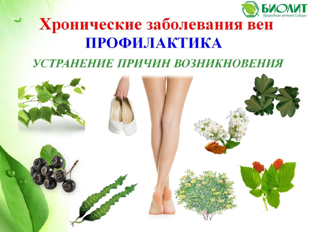 Здоровье вен