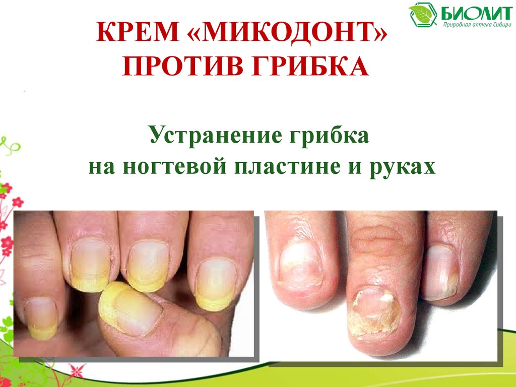 Микодонт