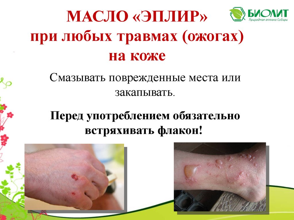Эплир