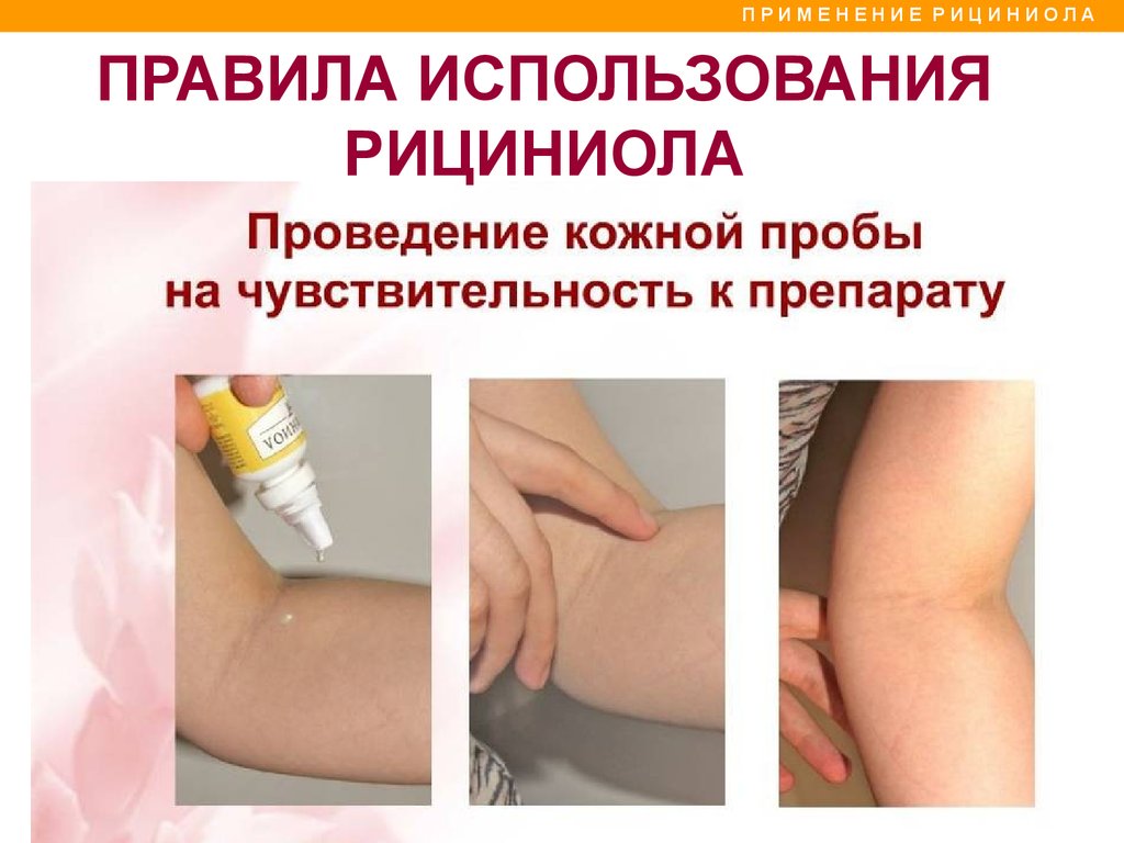Рициниол Арго