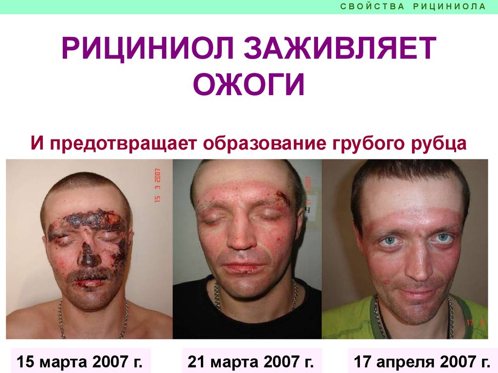 Рициниол