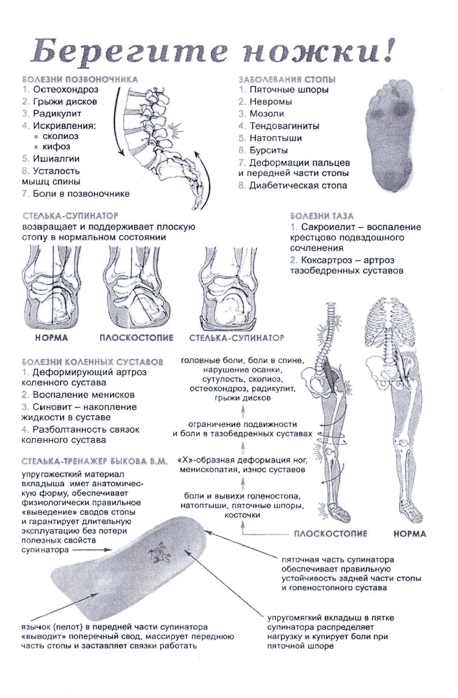 Стельки Быкова